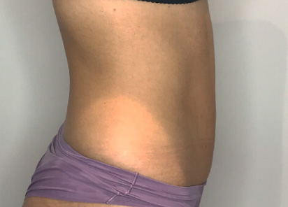 depois/after