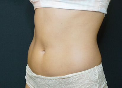 antes/before